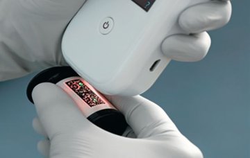 Xprecia Systems PT/INR-Teststreifen (4 x 25 Stück)