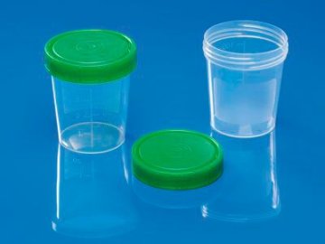 Urinbecher ohne Schraubdeckel (100 ml) (1000 Stück)