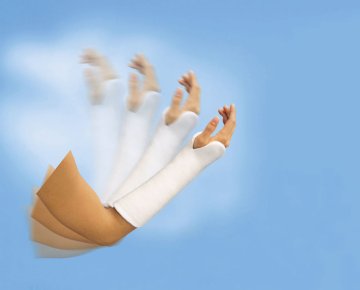 Essity Dynacast Prelude Schienensystem Gepolstert Beidseitig Für Ruhigstellung