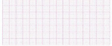 EKG-P., Hellige MicroSmart/ Mac 500, 360 Blatt (90 mm x 90 mm)