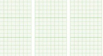 EKG-P., Dimeq EKG-503 A/E Rolle (145 mm x 30 m)