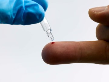 Quo Test Testset HbA1c, 15 Kartuschen 0031