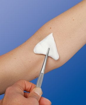 Fesmed Mulltupfer FES-TUPF Dreieckige Hütchenfaltung Absaugen Von Flüssigkeiten