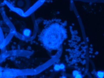 Fluoreszenz-Binokularmikroskop medicus pro Myko