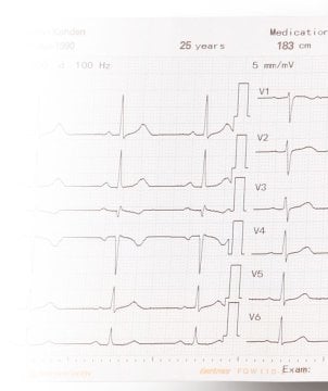 Thermopapier Gefaltet Für EKG-9022G / EKG-1250G / 2250 / 3250