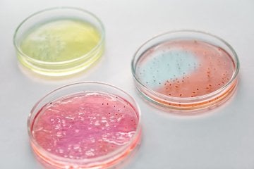 Nutriplate Fertignährböden Für Mikrobiologische Analysen In Der Humanmedizin