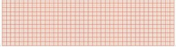 Diagramm Halbach EKG-Thermopapier für SCHILLER EKG