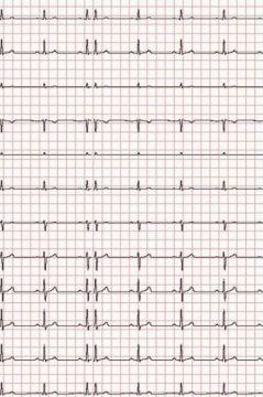 EKG-Papier zu Econet Medical, Cardio-M-Plus (210 mm x 30 m)