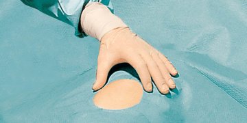 Hartmann Foliodrape® Protect Lochtücher selbstklebend