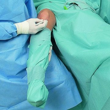 Hartmann Foliodrape® Arthroskopie-Set