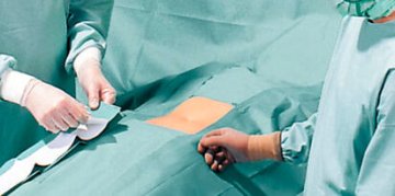 Hartmann Foliodrape Protect® Basis-/ Universal-Set