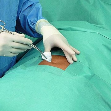 Hartmann Foliodrape Protect® Basis-/ Universal-Set