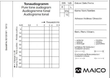 Tonaudiogrammblock ST 20, 5 Block á 50 Blatt