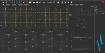 Dr. G. Schmidt EKG SmartScript PC-EKG-System